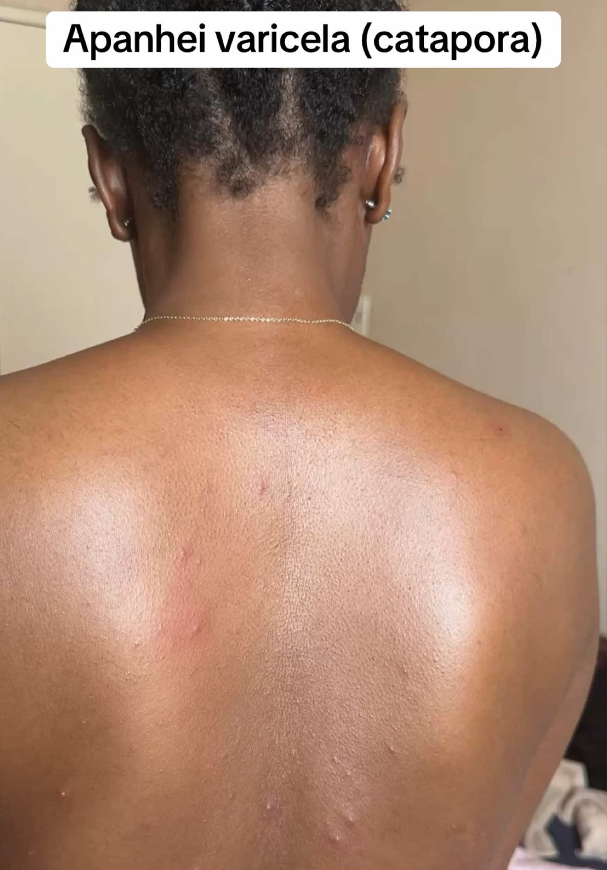 O que usar para tirar mancha?