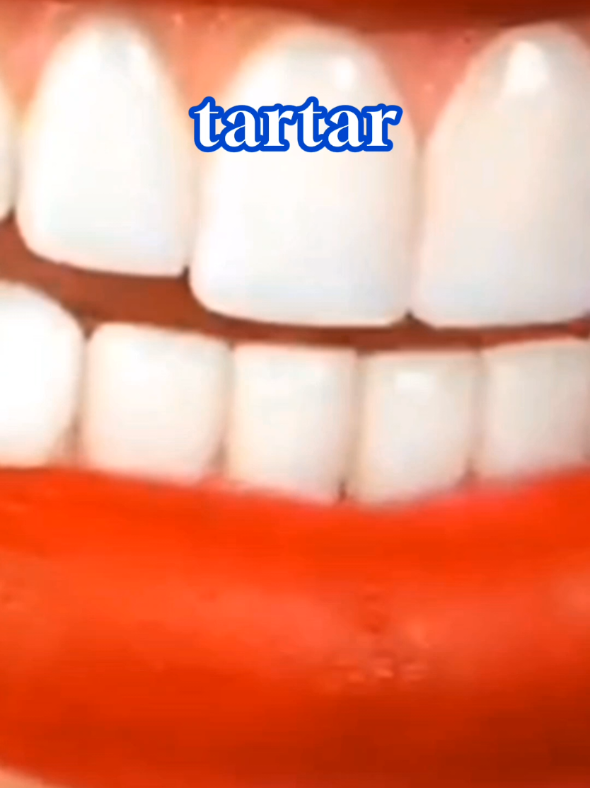 Whiten your teeth and remove tartar at home with this naturalrecipe. #teeth  #whitening  #teethwhitening #Recipe#teethwhiteninghack#whiteningteeth #teethcare#yellowteeth #naturalremedies#naturalremedy#600leilah@600Leilah @600Leilah 