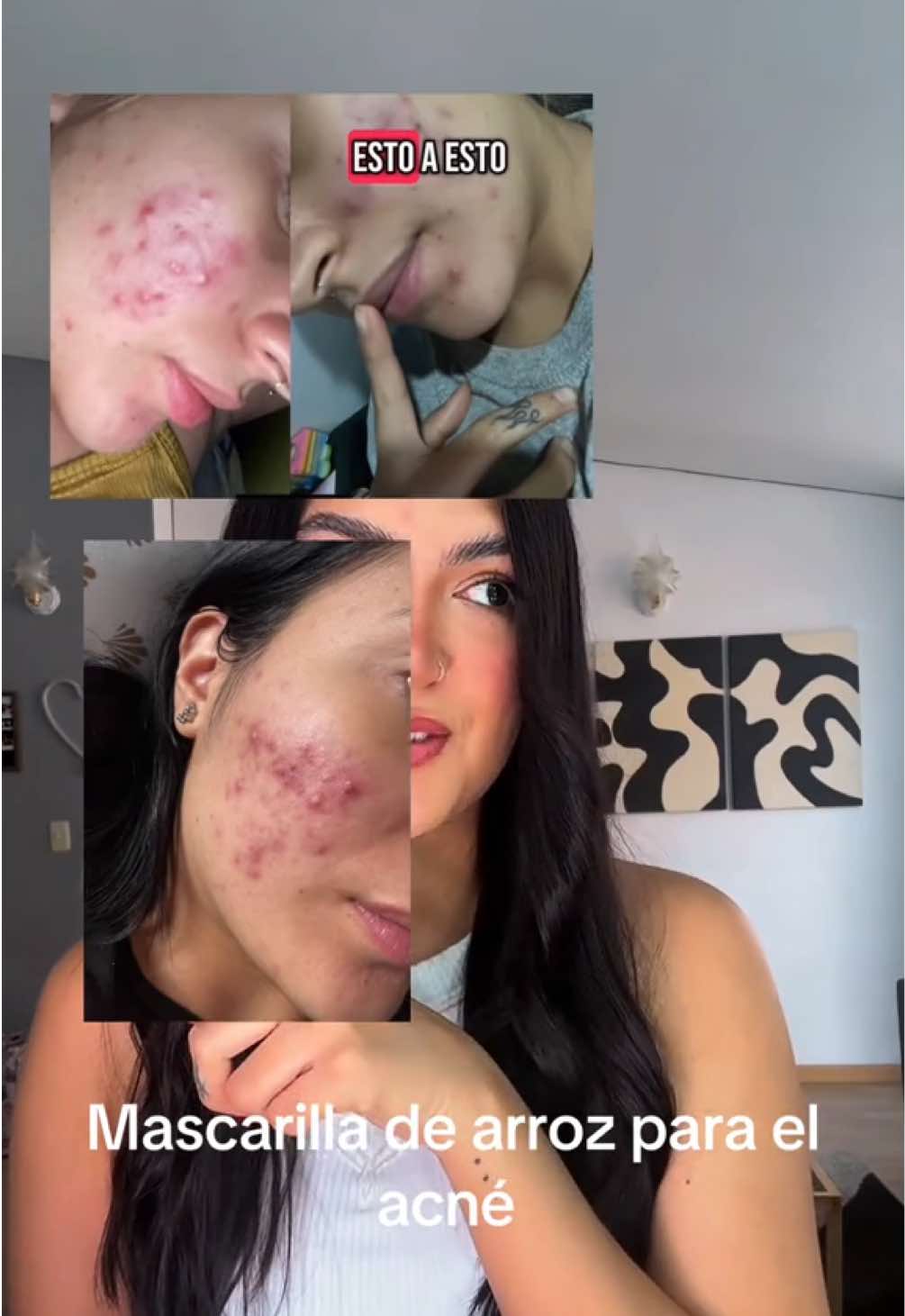 Mascarilla de arroz para el acné #tips #mascarillas #mascarillacasera #mascarilladearroz #tratamientonatural 