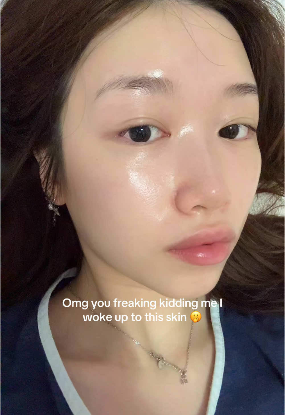 Exposing my bare face but I do NOT care anymore cause brb guys, I’ll make a video on how I got glowy skin 😭💗
