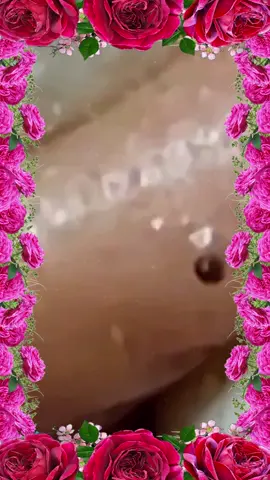 Realmente satisfatório de assistir 😴😍#relaxing #satisfyingvideo #removal #toenail