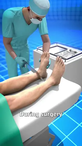 When they removed the wrong foot during surgery 💀