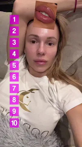 Gdzie są zęby dla największej fetyszystki RP?!!?🦷