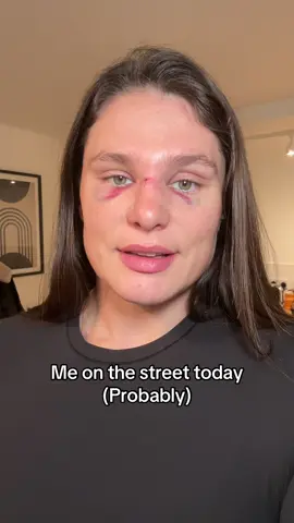 I’m assuming this is how things will turn out