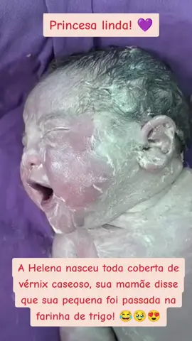 Vérnix Caseoso! #vernix #vernixcaseosa #maternidade #rn #nene 