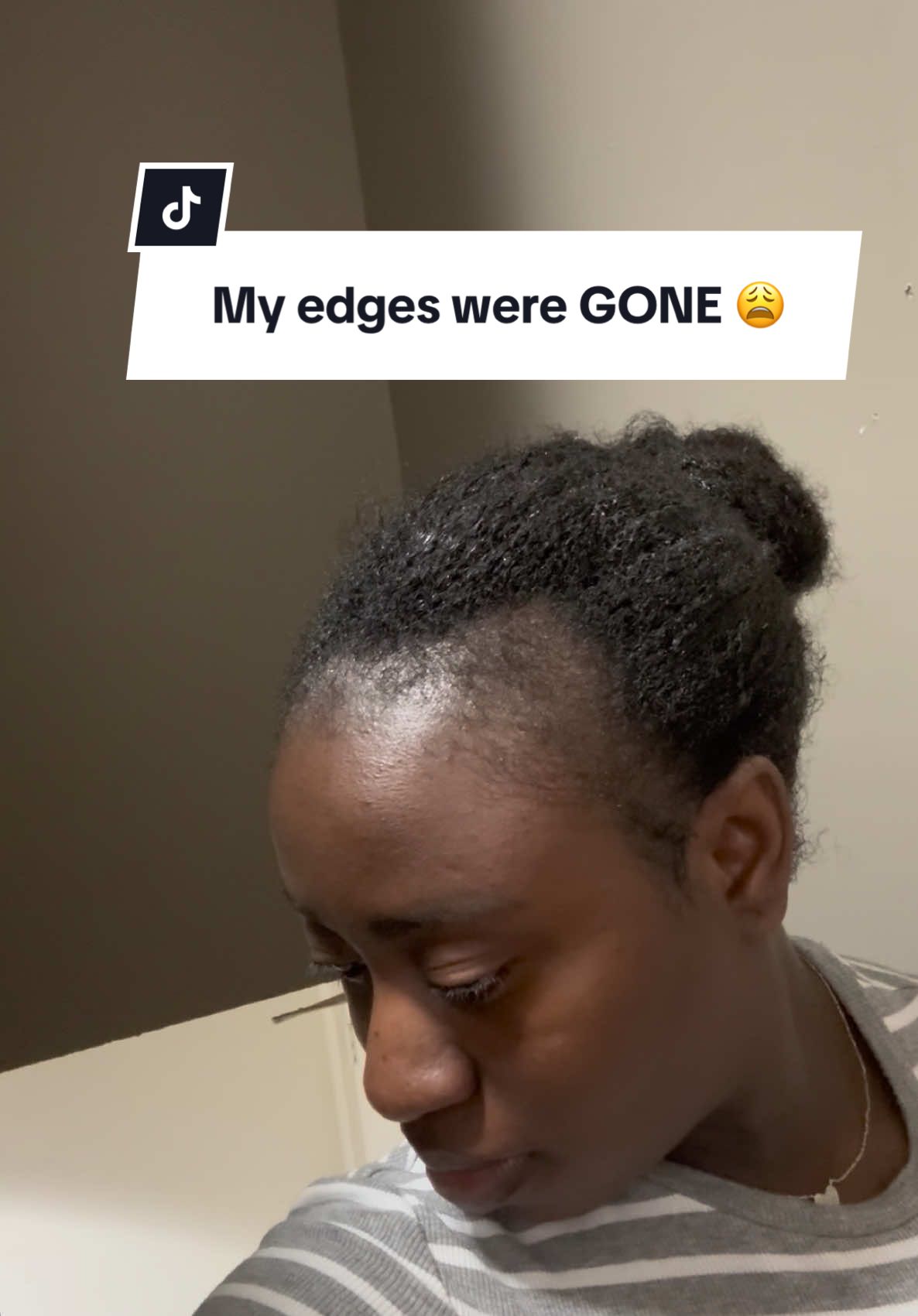 My edges went through a LOT in 2024 😩😭 but we thank God for restoration 🙌🏾🙌🏾😂 #hairgrowth #hairgrowthtips #haircareroutine #naturalhair 