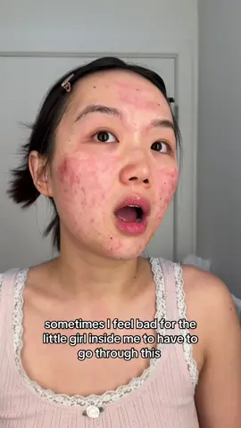 No one deserves to go through this. It’s so hard to get better and then feel worse again. You’d think I’d be used to it by now, but it’s never that easy 🥺. If you’re going through this too, just know you’re not alone 🫂❤️‍🩹 #acne #hormonalacne 