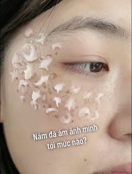 Hết nám, tàn nhang tự tin khoe sắc nè các nàng #kemnam #trinamtannhang #tannhang #cafune #cafuné #xuhuong #foryou #fyp