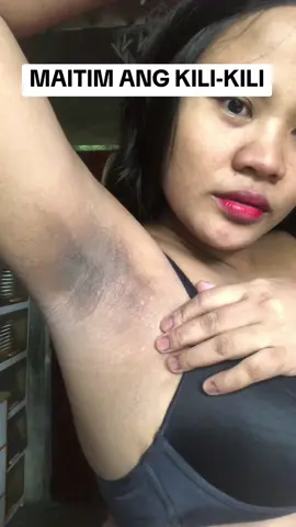 3 months applying miracle tawas sa kili-kili ko!!#miracletawaswithcalamansicream 