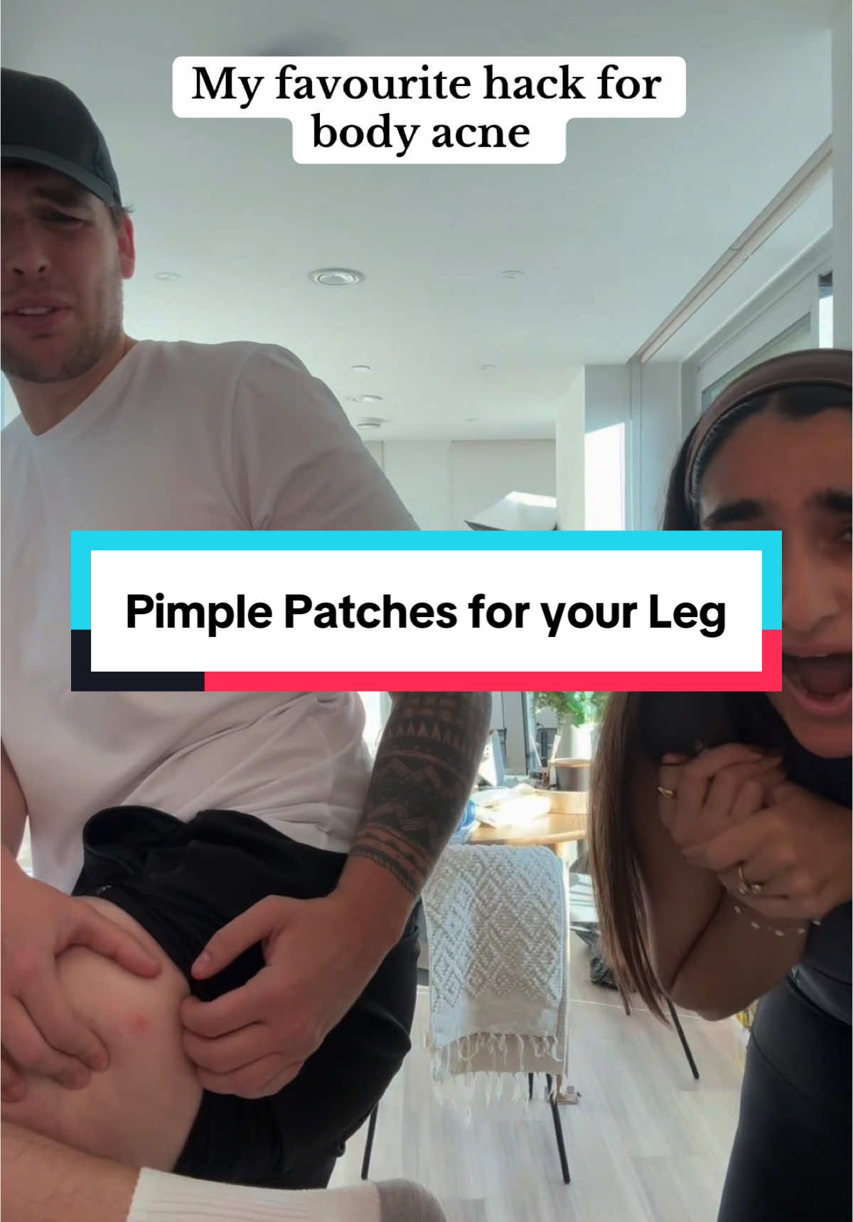 Pimple patches are not just for your face! @Nature Spell #spotpatch #pimplepatch #bodyacne #tiktokmademebuyit #dealdrop 