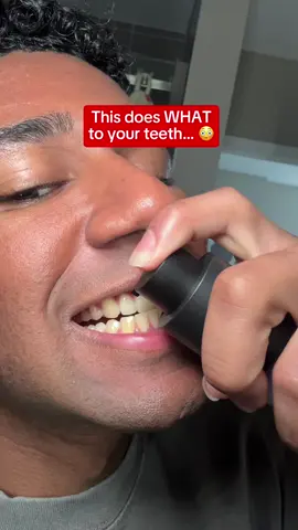 Your smile deserves the VIP treatment 💜 Snow Purple Serum: effortless whitening with serious results. #SmileBright #teethwhitening #teethtok #dentalcare #OralHealth #teethcare