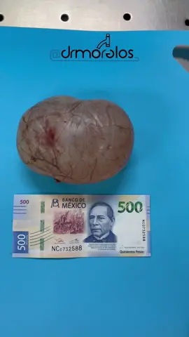 Envía este video a tu amigo que estudia medicina #drmorelos 