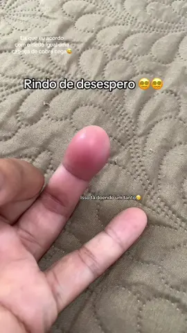 Uma dor que só Deus na minha vidinha viu🥲🥲 . Canto de unha inflamada❌❌ #cantodeunha #inflamado #fyppppppppppppppppppppppp #fouryou #cobracega 