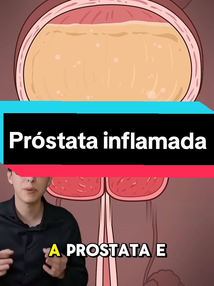 Próstata inflamada. #prostata #hiperplasiaprostatica #homes #saude 