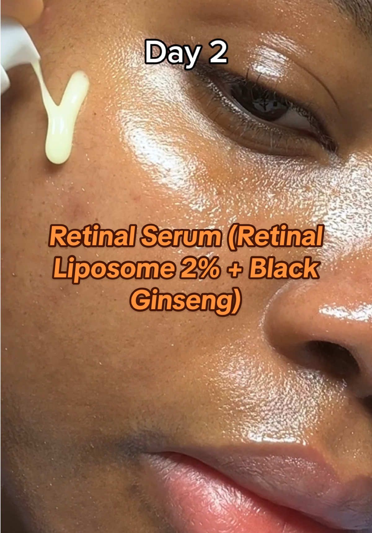 7 days Retinal journey with ksecret Seoul 1988  #skincare #clearskin #glassskinroutine #skintok #kbeauty #koreanskincare #skincareroutine #7days #retinol #retinal #retinoids #retinalserum #acneserum #poreserum #rednessserum  AD| @KSECRET GLOBAL 