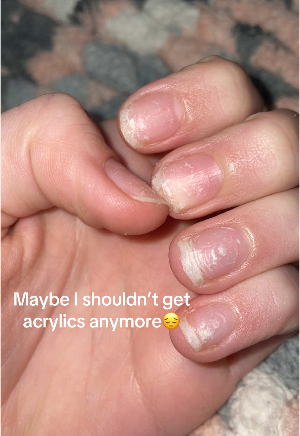 Or maybe I shouldn’t rip them off🤷‍♀️#jesuslovesyou #secret #spam #fypシ゚viral #acrylicnails #damaged 