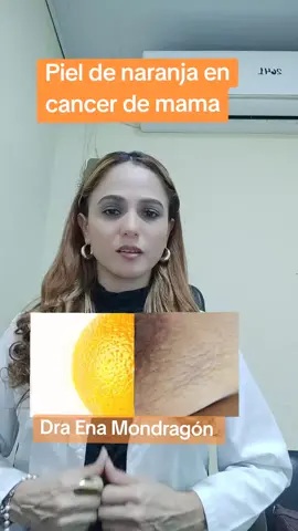 Hablemos un poco de uno de los síntomas del cáncer de mama, la piel de naranja que es esto?#medicosdetiktok #radiologa #parati 
