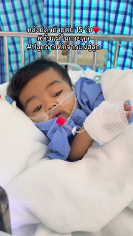 15วัน หลังจากที่ได้ตับวิเศษ จากแม่😊♥️ #ปลูกถ่ายตับจากแม่สู่ลูก #ตับแม่ในกายลูก #โรคท่อน้ําดีตีบตัน #โรงพยาบาลจุฬาลงกรณ์ #หนูน้อยโรคตับ 