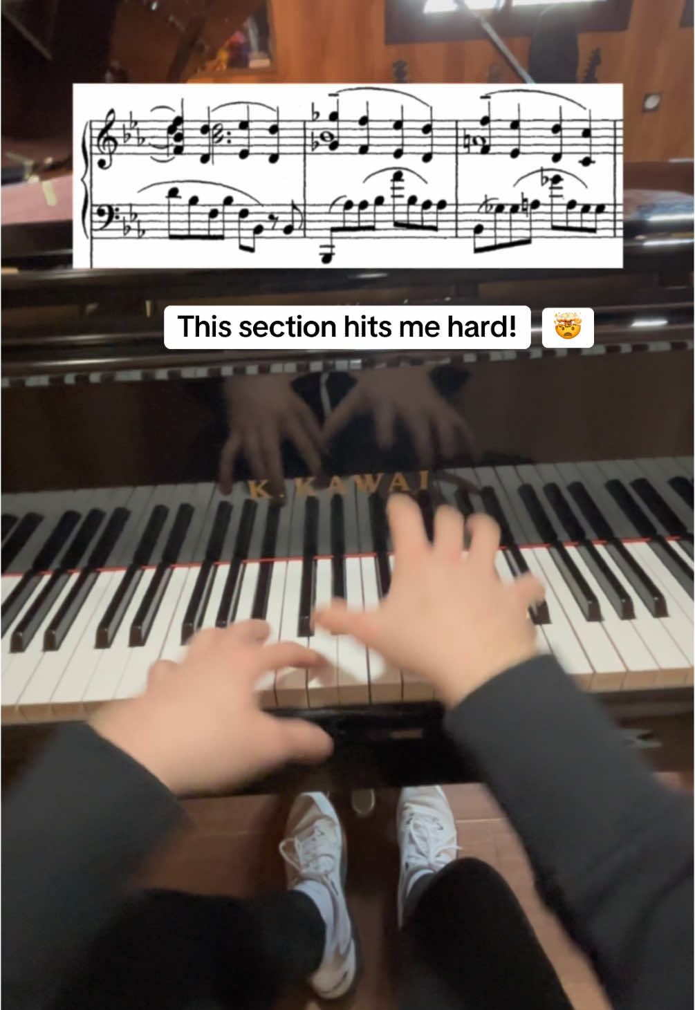 Para mí, la mejor melodía de todo el concierto. Probablemente todos la reconocemos y es una de las secciones más emocionales 😍🎹 ___________________ #rachmaninoff #chopin #liszt #beethoven #pianocover #classicalmusic #classicalpiano #rachmaninoffpianoconcertono2 #pianist #pianistofinstagram #pianotutorial #viralvideos #pianoscore