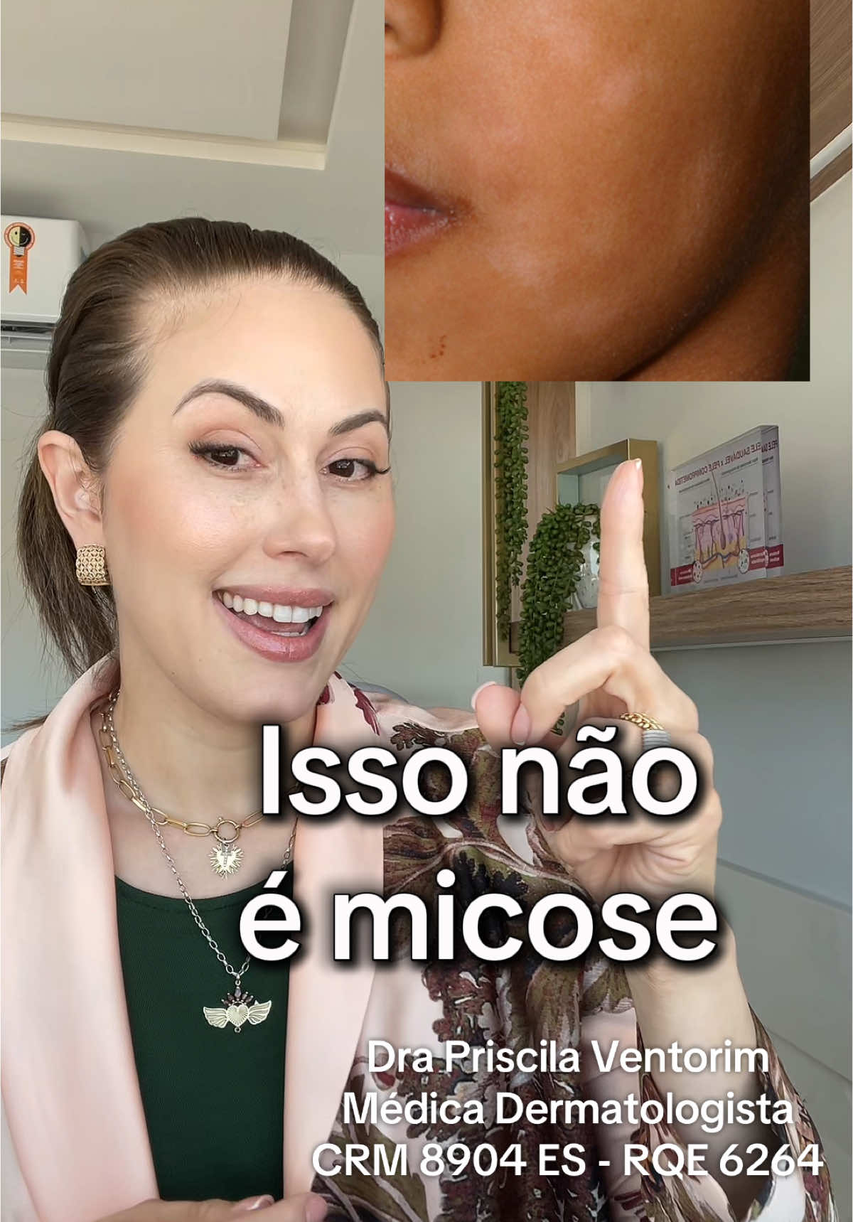 #micose #panobranco #viral_video #fungo #skincare #dermatologia #medico #medicina #tratamentoparapele #dermatiteatopica #mancha #pele #pelebonita #acneskin #skincareviral #fyp #pele #dermato #dermatologist #manchas 