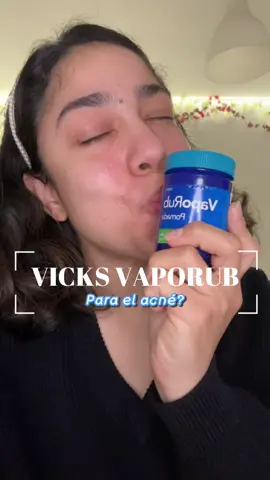 El Vicky Vaporub es mi mejor aliado cuando llegan esos granitos inesperados y dolorosos, en cuestión de Max 3 días ya se ha deshinchado esa área de la piel y desvanecido en su totalidad. Y tú, lo has probado? te ha funcionado? Déjame saberlo en los comentarios 🫶🏻 #CapCut #tecuentomisecreto #bootcampdeuntalfredo #vicks #SkinCare #tipsforgirls 