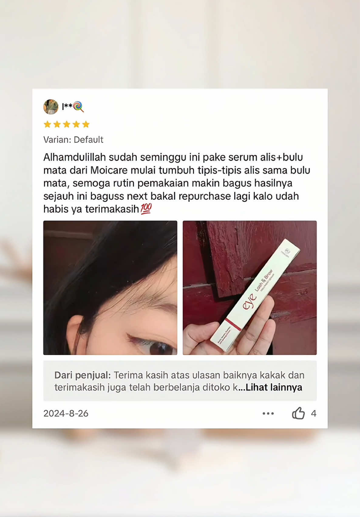 JANGAN TAKUT LAGI YA DEK YAAA 🥹 kali ini percayakan sama serum moicare, tenang-tenang sampai ada garansi uang kembali loh. so, gausah resah lagi ya bestie 🥰