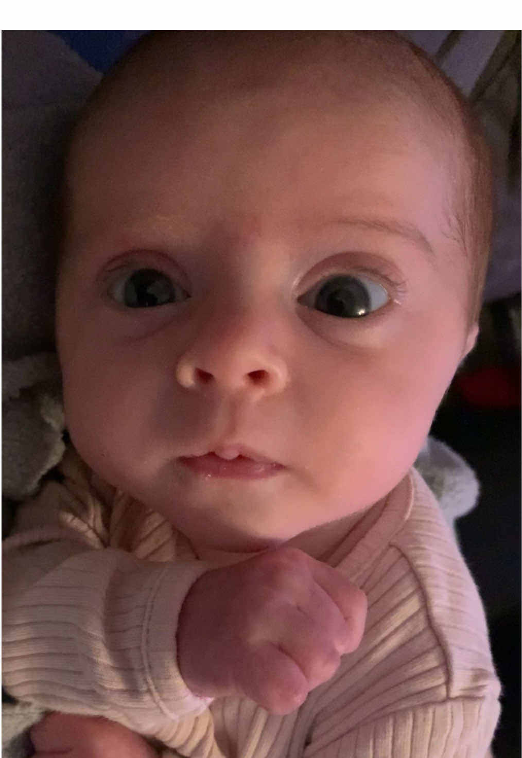 Noticing Nora’s squint from birth leading to her diagnosis at 1 year old 🌟#babyglasses#opthamology #optometrist #optician #glasses#squint #lazyeye #babytok #toddlersoftiktok #cute#baby#littlegirl#askmeanything 