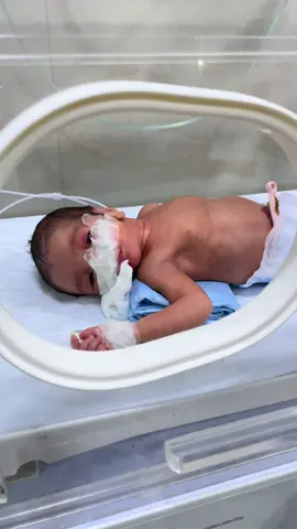 Sick 🤒 Baby In Nursery! please Pray 🙏  #PrematureBaby #LowBirthWeight #OxygenSupport #NeonatalCare #RoyalNurseryUnit #InfantHealth #SevereChestInfection 