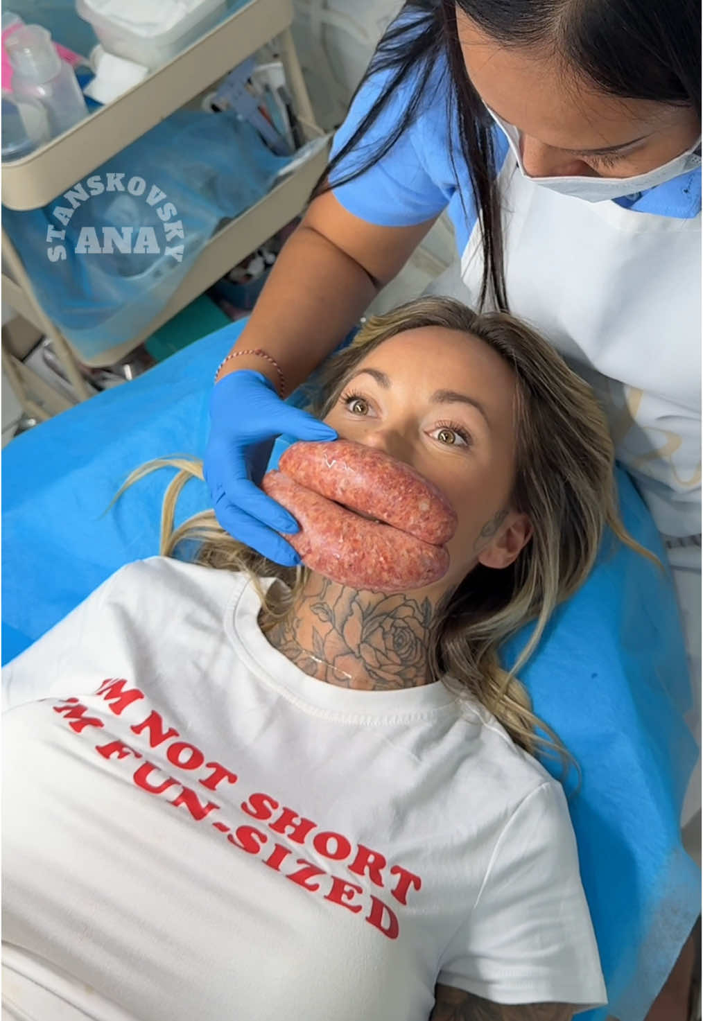 Keep it natural 👌🏼 #fyp #lips #lipfiller 