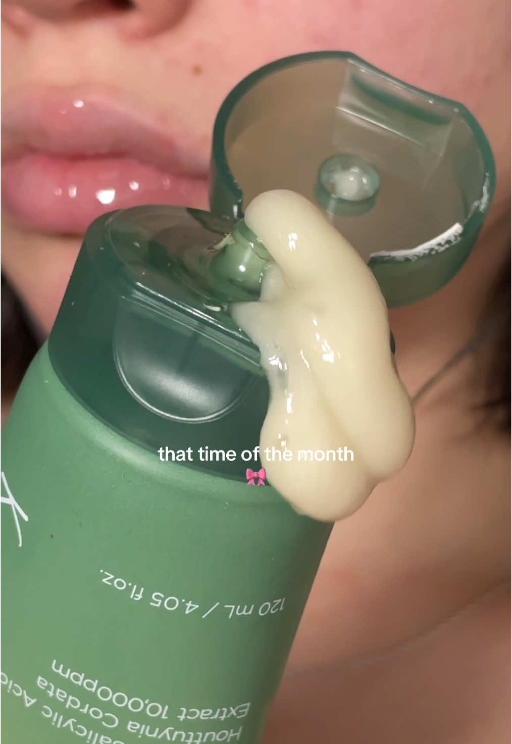 I’m not a big fan of peeling, I was traumatized, haha, but I love this one🤍🔆 #kbeauty #koreanskincare #peeling #peelingskin #anua 
