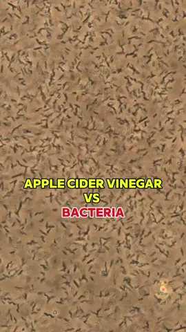 #applecidervinegar #bacteria #microscope #intersting #fyp 