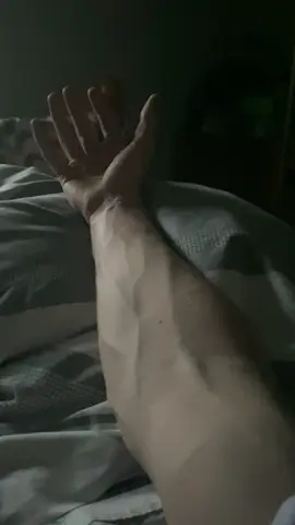 Hi 🎀 what do u think?#veinyhands #vascular #armveins #hands #fyp #vein #veins #veiny