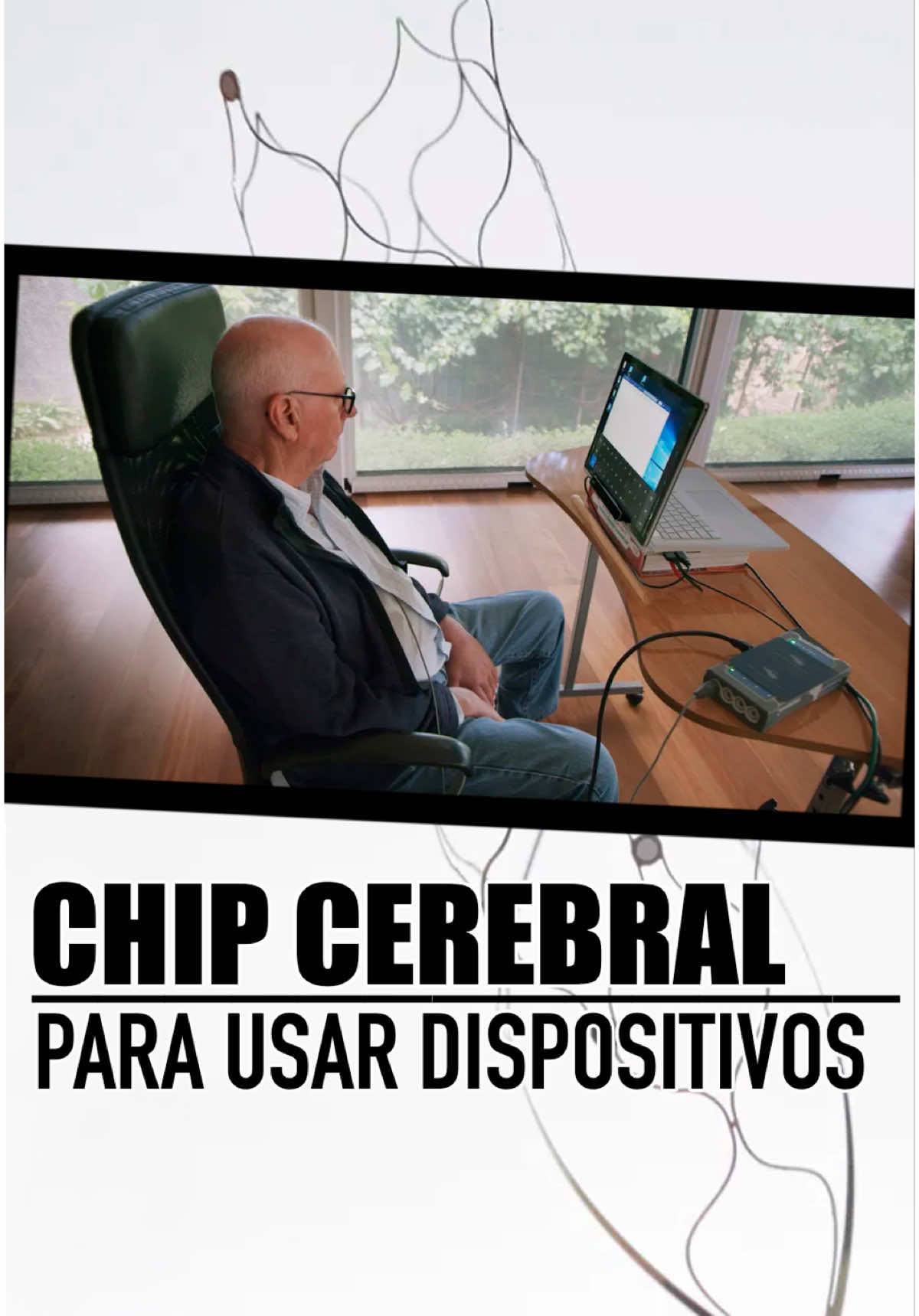 Este dispositivo está hecho para estar en el cerebro y permitir a la gente con parálisis controlar sus celulares, computadores y mucho más, usando solo los pensamientos. ¿Y cómo funciona? Pues se usan los vasos sanguíneos como carretera principal hacia el interior del cerebro, generando así enlaces por dentro con electrodos y sensores que pueden grabar actividad desde el cerebro. Esas señales viajan a través de un cable y salen del cuerpo hacia una unidad de telemetría que va hacia una computadora, y esas señales son interpretadas por la misma. Una buena forma de explicarlo: es como si tuvieras un bluetooth para manejar tu computadora o dispositivo donde no hay necesidad de un teclado o un mouse, totalmente libre de manos y solo con el cerebro. Ahora el paciente puede ver su correo, navegar por la web, como cualquier otra persona, haciendo uso de su cerebro y sus ojos. Gracias a la tecnología estas personas recuperan gran parte de su independencia, y pueden aspirar así a tener vidas con menos privaciones.  --- #tecnologia #adaptateoapartate #diegoquiroz 