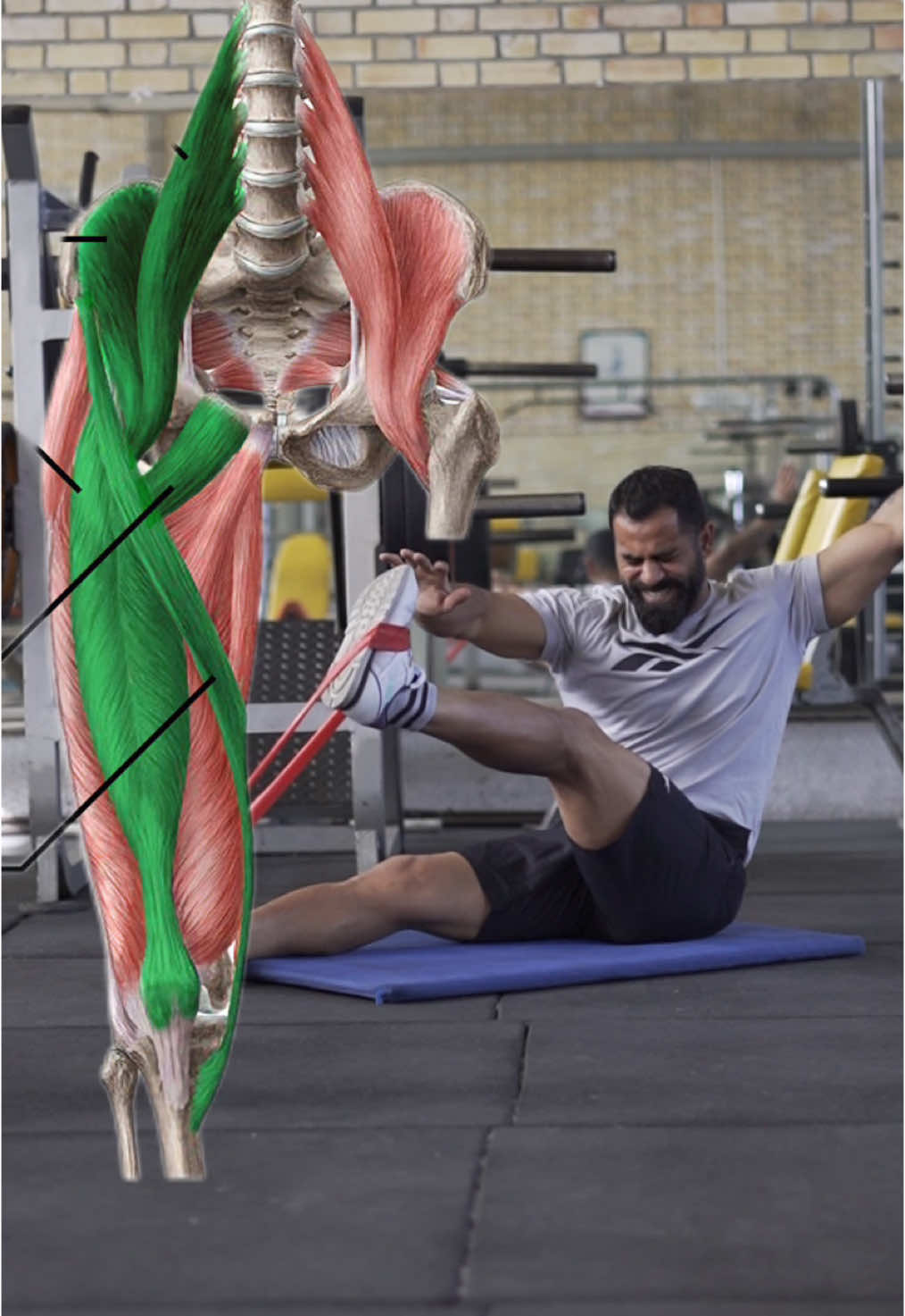 #band #loop #groin #resistancebands  ‼️ Why You Should Try Mini Loop Band Exercises?  Exercising with mini loop bands targets the deep muscles of the body and is beneficial for athletes for the following reasons: 1️⃣ Strengthening Deep Muscles: This exercise activates muscles that are less engaged in traditional workouts and play a key role in body stability. 2️⃣ Improving Balance and Stability: By increasing the strength of deep muscles, control and balance of the body are enhanced; ideal for athletes and rehabilitation. 3️⃣ Reducing Injury Risk: Strengthening deep muscles supports joints and bones, decreasing the likelihood of injury. 4️⃣ Increasing Range of Motion: These exercises help improve flexibility and increase the range of motion in the joints. 5️⃣ Variety in Workouts: Mini loop bands add an exciting variety to your workout routine, making exercise more engaging. 6️⃣ Easy Portability: Lightweight and portable, perfect for working out anytime and anywhere! #groin #lowerbodyworkout #football #UFC #tennis #fighter #UFC #tennis #fighter #volleyball #abs #injuryprevention #leg #athletic #aminhashemi #resistancebandsworkout 