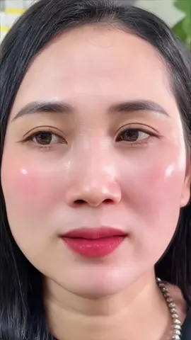 Peel xong xài tinh chất căng bóng là mê luôn #tàn_nhang  #nám  #peel  