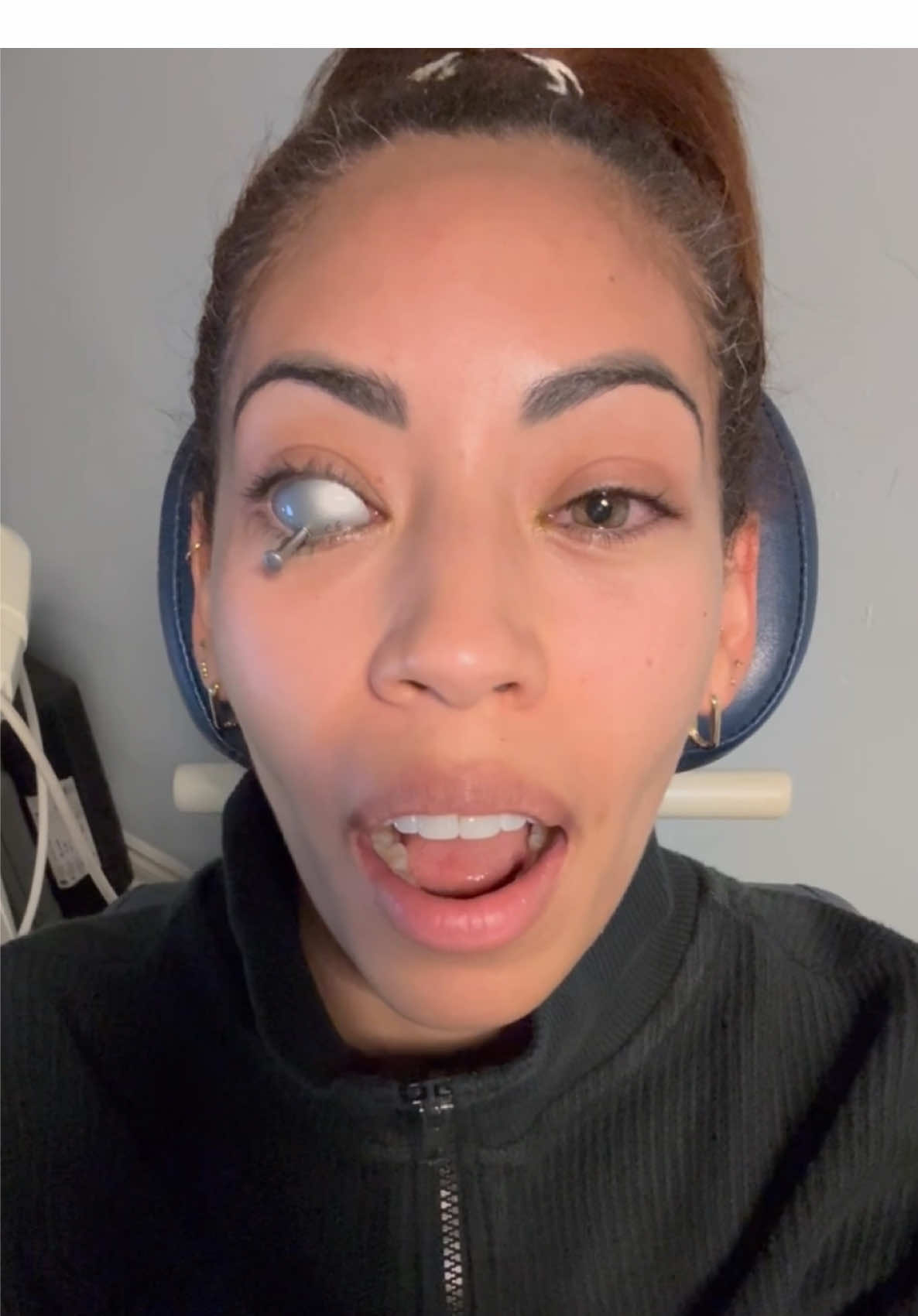 I can’t believe my eyes! 👁️ #eyes #eyehealth #dryeyes 