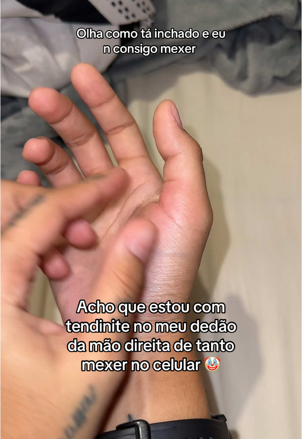 Tendinite no dedão de tanto usar celular ????
