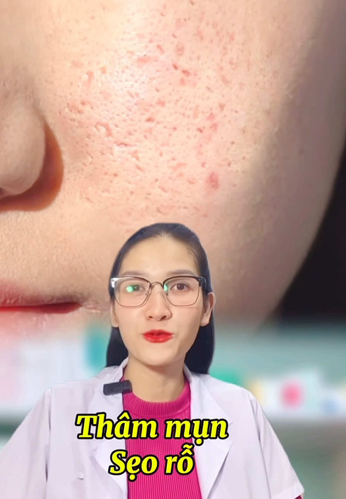 Bạn nào thâm mụn, sẹo rỗ, sẹo mụn tham khảo serum Ginseng new skin nhé #thaods #tdkskin #serumnewskin #seoro #mun #lamdep #skincare 