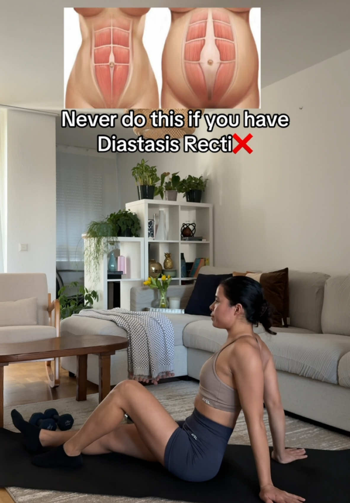 If you're recovering from diastasis recti, avoid exercises that shown in video. High-Impact Exercises like Running and heavy lifting can strain your core and pelvic floor, risking injury. Focus on rebuilding core strength first.#coreworkouts #postpartumjourney #postpartumworkout #diastasisrecti #diastasisrectirecovery #postbabyworkout #fyp #nepalifitness #fitnesstiktok #fitnesstiktok #FitTok #2025 #momfitnessjourney 