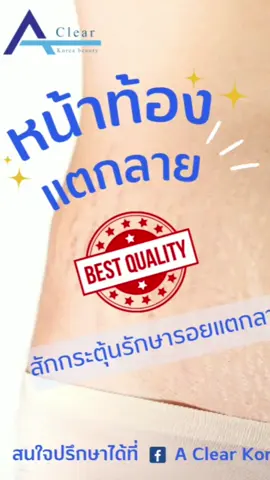 #รักษารอยแตกลาย  #สักกระตุ้นคอลลาเจน  #คนไทยเป็นคนตลก  #tiktokviral  #ท้องลาย  #ท้องแตกลาย  #ผิวแตกลาย  #ความงาม 