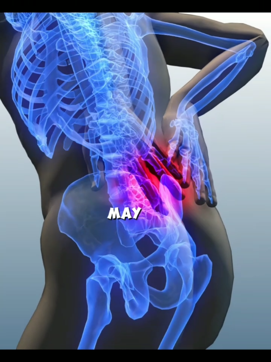 Back Surgery_ Lumbar Disc Replacement #backpain #LumbarDisc #disc #legnerve #lumbarspine #intervertebraldisc #nerves #Sciatica #bone #healthcare 