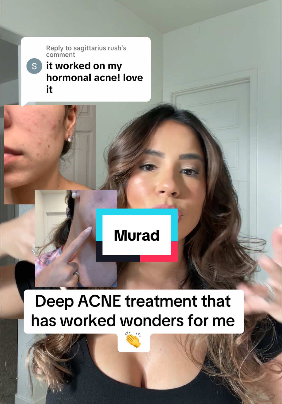 Replying to @sagittarius rush it’s the only skincare product that I will repurchase over and over again.  #hormonebalance #hormonalacne #acnetreatments #acneskin #acneproneskin #acneskin 