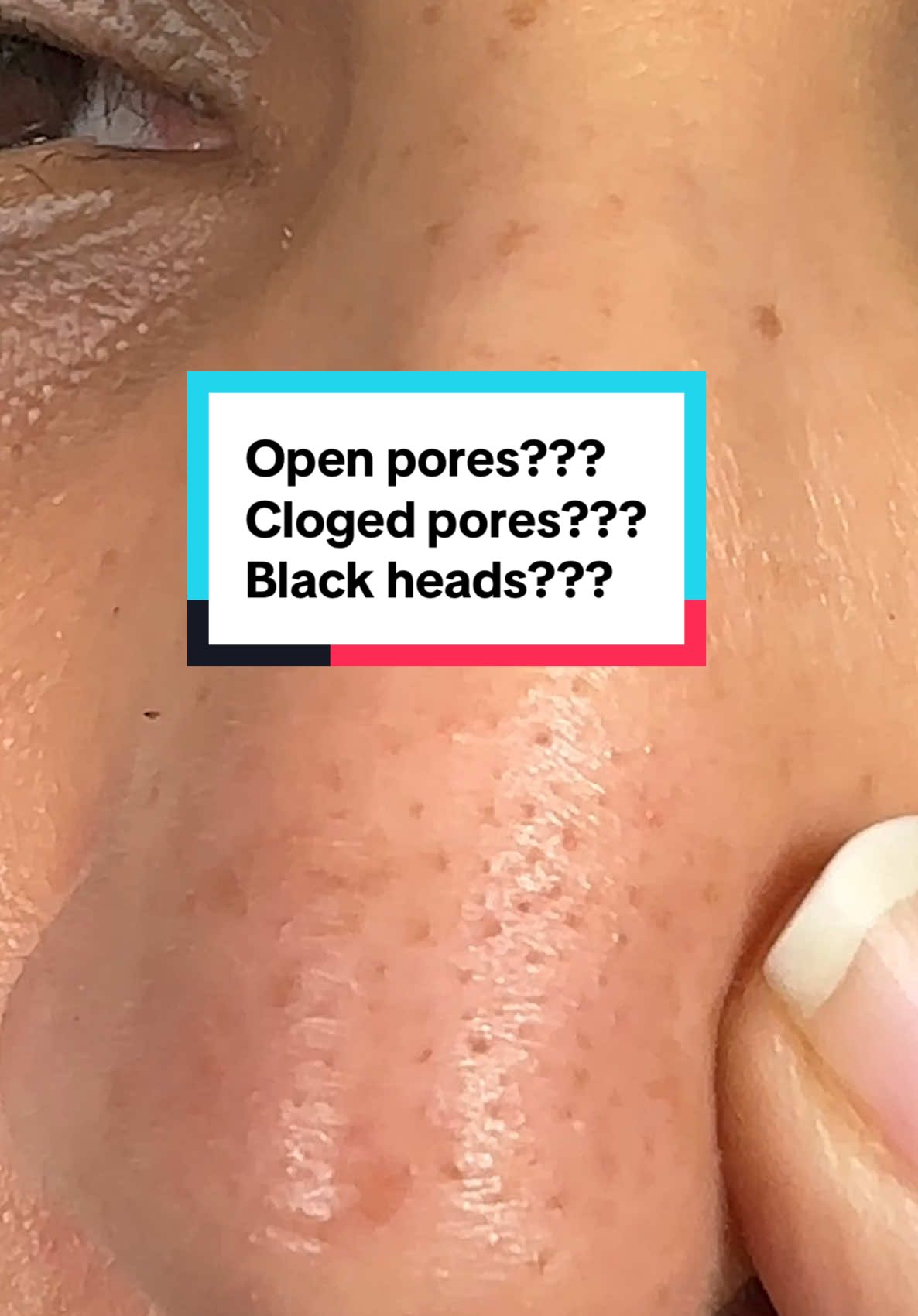 @fully___official  #fullyricedoughmask #ricemodelingmask #riceskincare  #greentomatocream #deepglow @FULLY Skincare  #fullygreentomato  #poreperfectmask #fullyskincare #kbeauty #koreanskincare #openpores #bleckheadremoval 