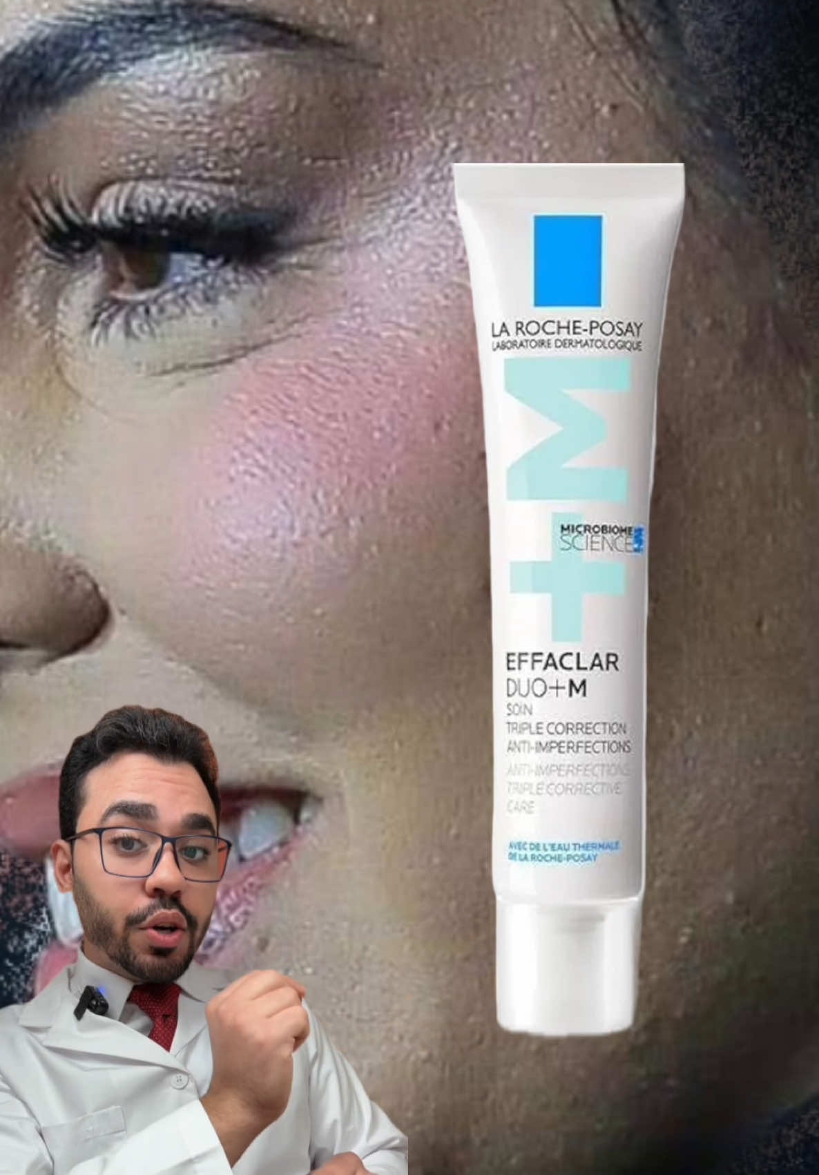 بشرة المشاهير بدون فلتر 