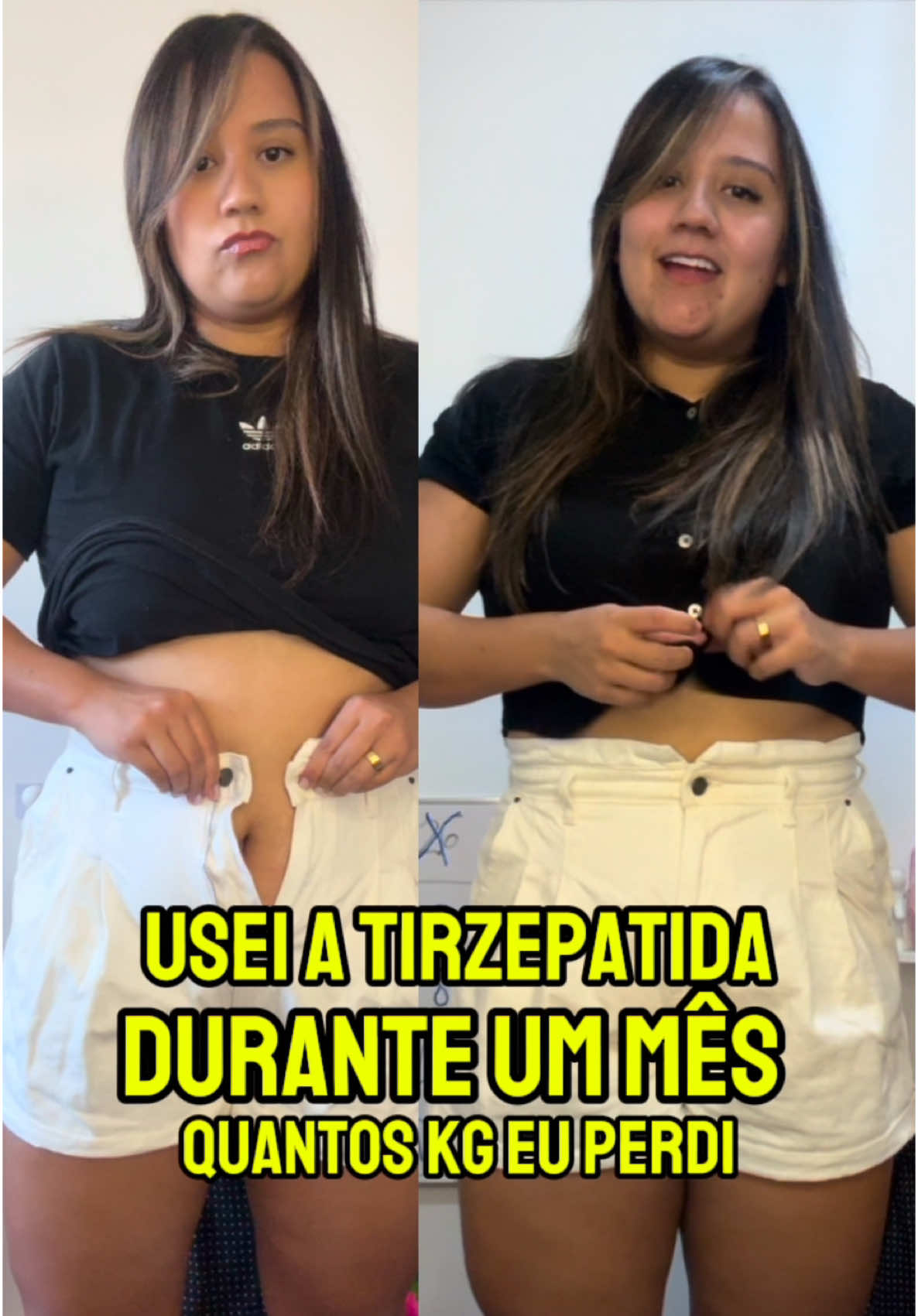 Não é fácil, mas estou no processo de emagrecimento #emagrecimento #rotina #vlogderotina #tirzepatida #moujaro 