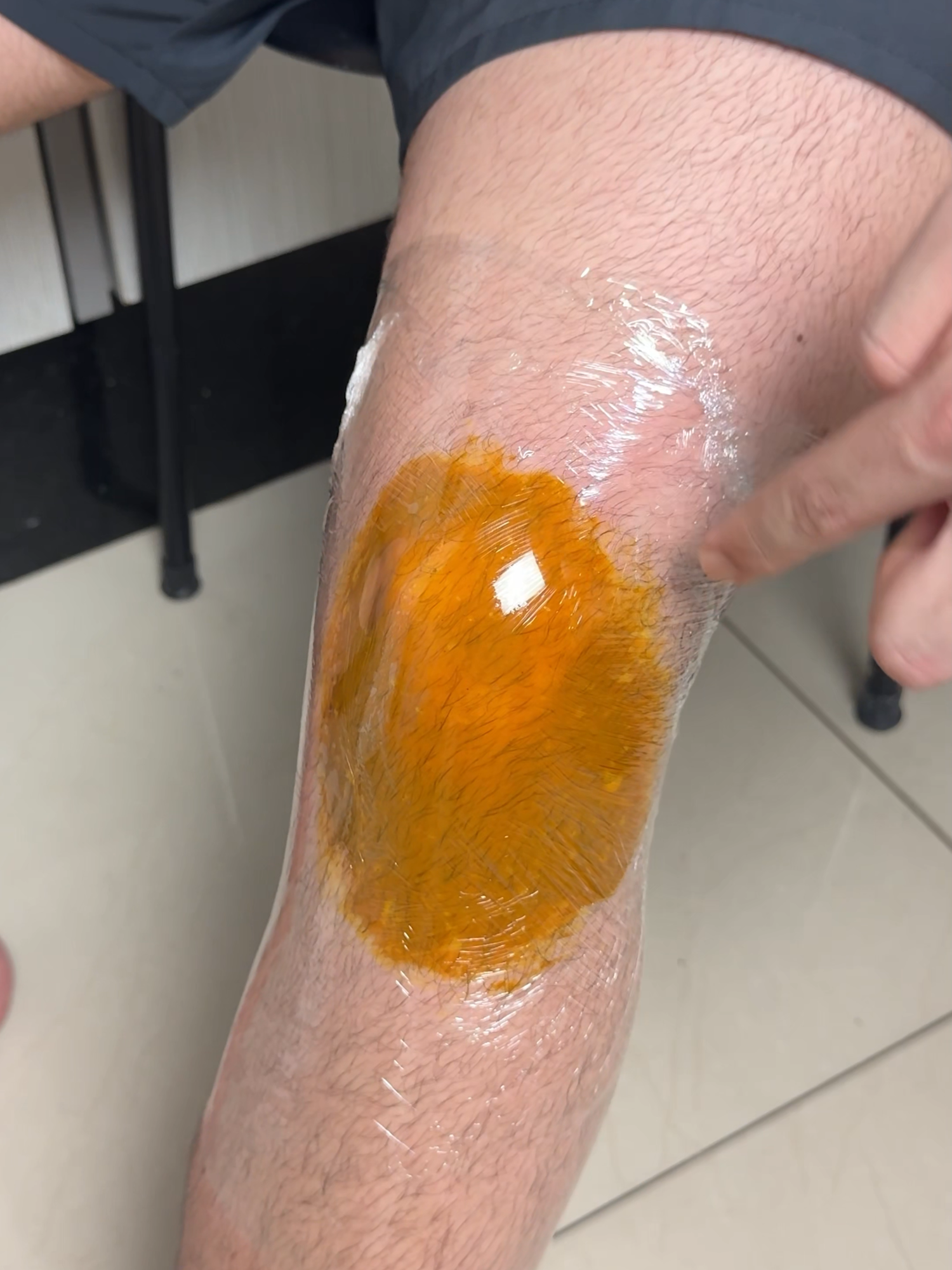 Say goodbye to knee pain with this magical natural solution! #homehacks #kneepain #kneepainrelief #fyp #fypviral #fypviralシviral