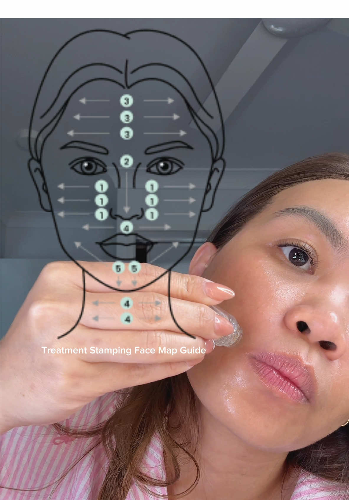 Give yourself a clinic-quality glow in the comfort of your home ✨💉 Qure Microinfusion is the secret to radiant, flawless skin—anytime, anywhere! #GlowAtHome #SkinCareGoal #quremicroinfusion #skinneedling @Qure™ Skincare 