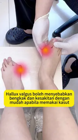 Bengkak dan bengkak sendi jari kaki guna krim jari kaki ni untuk hilangkan sakit #ibujari #jarikaki #sakitsendi #Kisarkakianda #TikTokShop #fyp #malaysia. 
