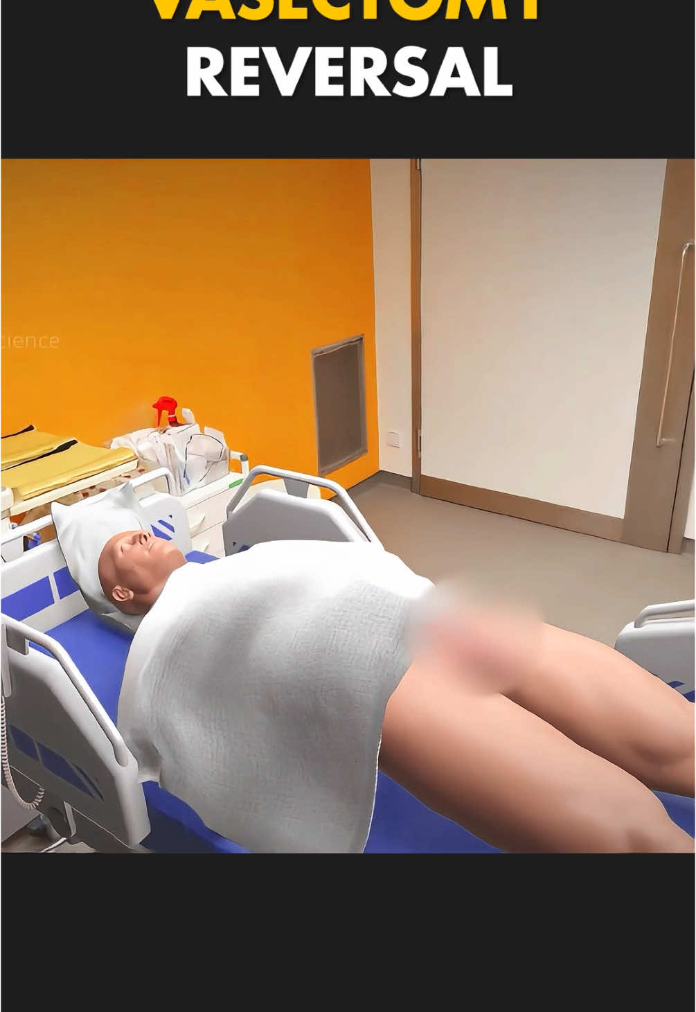 Vasectomy Reversal Surgery (3D Animation) #vasectomyreversal #vasectomyreversalbaby #vasectomy #vasectomysurgery #birthcontroloptions #birthcontrol #birthcontroloptions #medical3danimation #3dmedicalanimation 