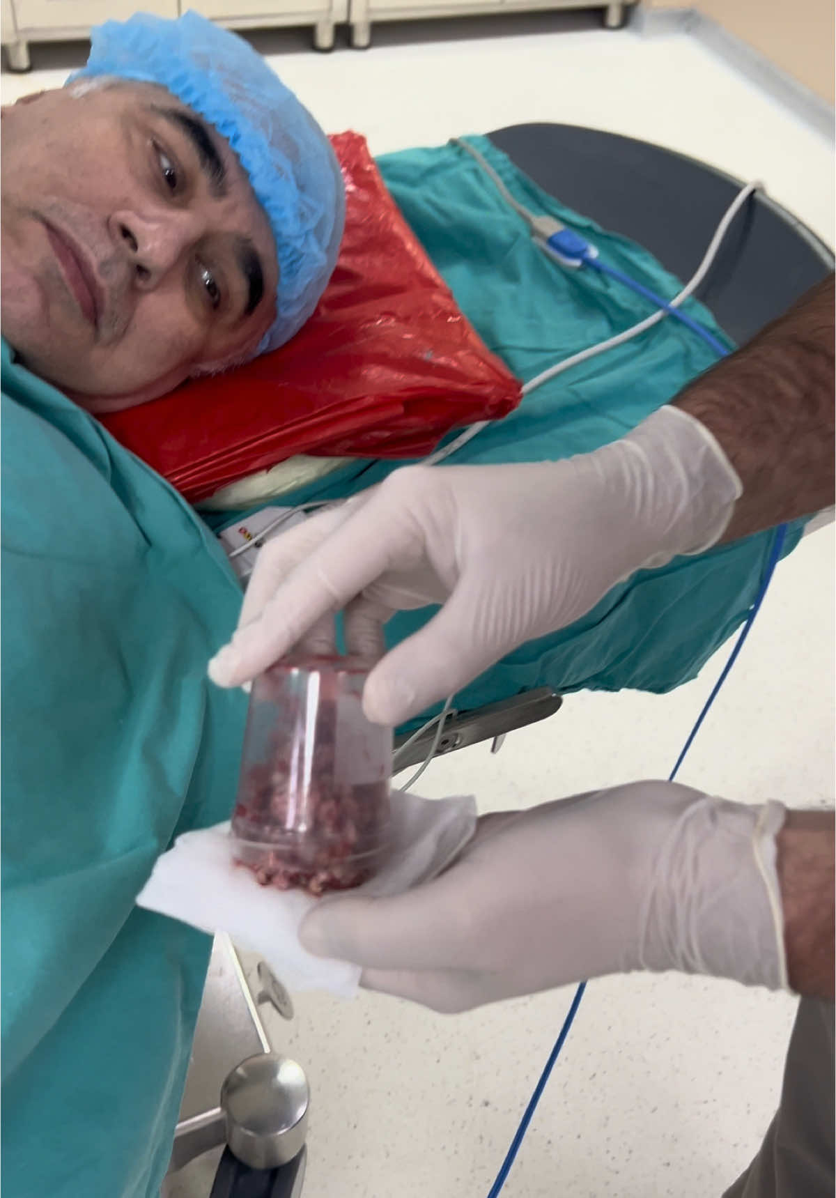 #urolog #üroloji #urology #androloq #andrology #prostat #böyrək #surgeon #cerrah #turprostat 